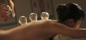 cupping-3